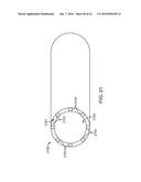 TOOL AND METHOD FOR USING SURGICAL ENDOSCOPE WITH SPIRAL LUMENS diagram and image