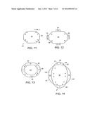 Implanatable Medical Device for Improved Placement and Adherence in the     Body diagram and image