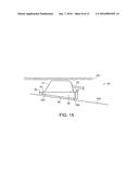 Implanatable Medical Device for Improved Placement and Adherence in the     Body diagram and image