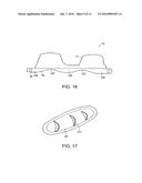 Implanatable Medical Device for Improved Placement and Adherence in the     Body diagram and image