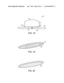 Implanatable Medical Device for Improved Placement and Adherence in the     Body diagram and image