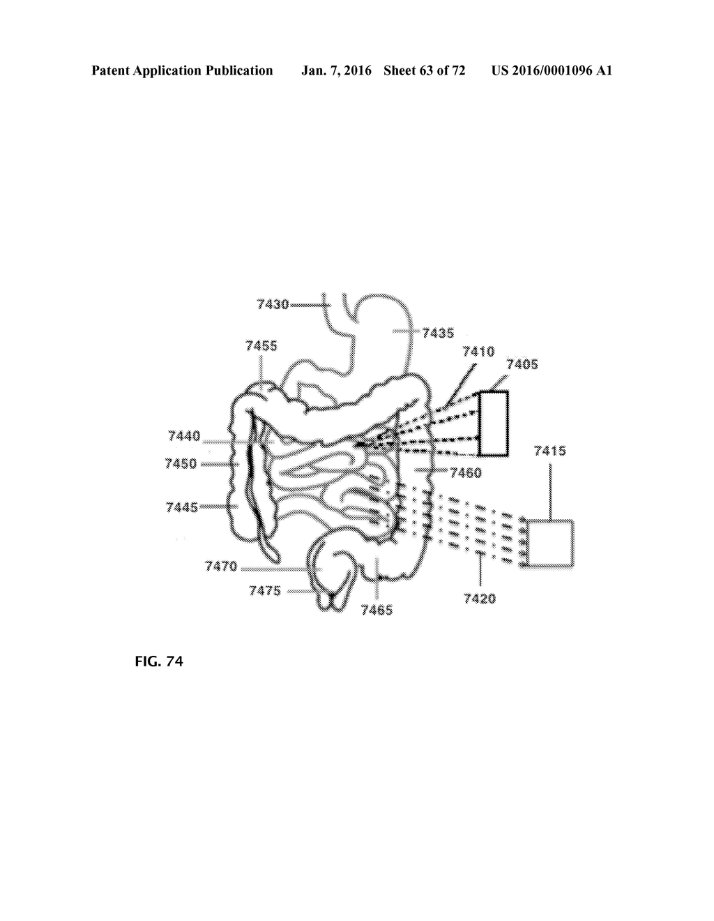 DEVICES AND METHODS FOR OPTIMIZED NEUROMODULATION AND THEIR APPLICATION - diagram, schematic, and image 64