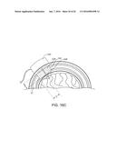 SYSTEMS, METHODS AND DEVICES FOR A SKULL/BRAIN INTERFACE diagram and image