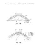 SYSTEMS, METHODS AND DEVICES FOR A SKULL/BRAIN INTERFACE diagram and image