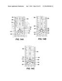 SUSPENSION SYSTEM diagram and image