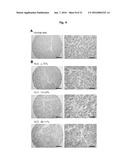 ANTIBODIES AGAINST TM4SF5 AND ANTICANCER COMPOSITIONS COMPRISING THE SAME diagram and image