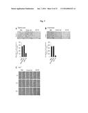 ANTIBODIES AGAINST TM4SF5 AND ANTICANCER COMPOSITIONS COMPRISING THE SAME diagram and image