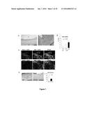 Notch Inhibition in the Prevention of Vein Graft Failure diagram and image