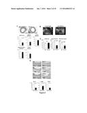 Notch Inhibition in the Prevention of Vein Graft Failure diagram and image