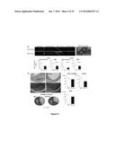 Notch Inhibition in the Prevention of Vein Graft Failure diagram and image