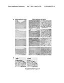 Notch Inhibition in the Prevention of Vein Graft Failure diagram and image