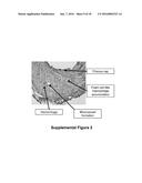 Notch Inhibition in the Prevention of Vein Graft Failure diagram and image