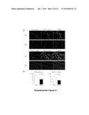 Notch Inhibition in the Prevention of Vein Graft Failure diagram and image