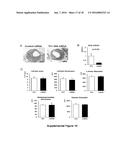 Notch Inhibition in the Prevention of Vein Graft Failure diagram and image