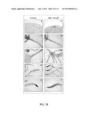 HAHB11 Provides Improved Plant Yield and Tolerance to Abiotic Stress diagram and image