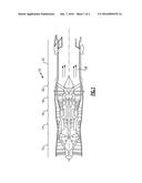 GAS TURBINE ENGINE STATOR VANE PLATFORM REINFORCEMENT diagram and image