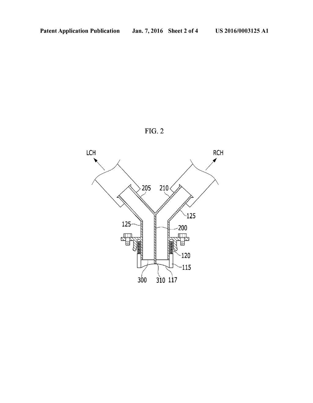 COOLANT CONTROL VALVE OF ENGINE - diagram, schematic, and image 03