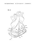 BEARING PLATE BLEED PORT FOR ROOTS-TYPE SUPERCHARGERS diagram and image