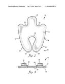 UNIVERSAL GUN HOLSTER diagram and image