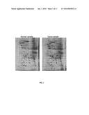 SPECIFIC BIOMARKER SET FOR NON-INVASIVE DIAGNOSIS OF LIVER CANCER diagram and image