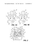 MICROPHONE ACCESSORY, A METHOD OF USING A MICROPHONE, AND A MICROPHONE diagram and image