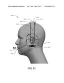 RESTRICTED BALL AND SOCKET JOINT FOR HEADSET EARCUP diagram and image