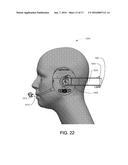 RESTRICTED BALL AND SOCKET JOINT FOR HEADSET EARCUP diagram and image