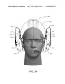 RESTRICTED BALL AND SOCKET JOINT FOR HEADSET EARCUP diagram and image