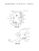 RESTRICTED BALL AND SOCKET JOINT FOR HEADSET EARCUP diagram and image