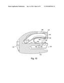 ZIP FASTENER diagram and image