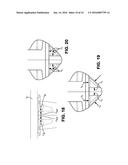 THREE DIMENSIONAL CONNECTION SYSTEM FOR BED FRAME diagram and image