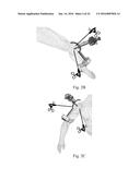 DEVICE AND METHOD FOR ASISSTING LAPAROSCOPIC SURGERY - RULE BASED APPROACH diagram and image