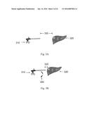 DEVICE AND METHOD FOR ASISSTING LAPAROSCOPIC SURGERY - RULE BASED APPROACH diagram and image