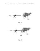 DEVICE AND METHOD FOR ASISSTING LAPAROSCOPIC SURGERY - RULE BASED APPROACH diagram and image