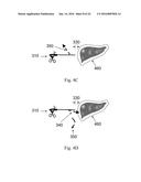 DEVICE AND METHOD FOR ASISSTING LAPAROSCOPIC SURGERY - RULE BASED APPROACH diagram and image