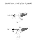 DEVICE AND METHOD FOR ASISSTING LAPAROSCOPIC SURGERY - RULE BASED APPROACH diagram and image