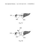 DEVICE AND METHOD FOR ASISSTING LAPAROSCOPIC SURGERY - RULE BASED APPROACH diagram and image