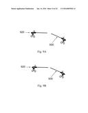 DEVICE AND METHOD FOR ASISSTING LAPAROSCOPIC SURGERY - RULE BASED APPROACH diagram and image