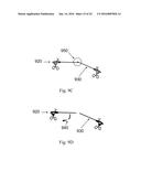 DEVICE AND METHOD FOR ASISSTING LAPAROSCOPIC SURGERY - RULE BASED APPROACH diagram and image