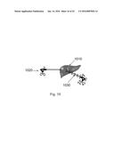 DEVICE AND METHOD FOR ASISSTING LAPAROSCOPIC SURGERY - RULE BASED APPROACH diagram and image