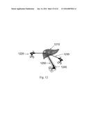 DEVICE AND METHOD FOR ASISSTING LAPAROSCOPIC SURGERY - RULE BASED APPROACH diagram and image