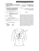 Ambulatory Electrocardiography Monitoring Patch Optimized For Capturing     Low Amplitude Cardiac Action Potential Propagation diagram and image