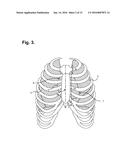 Ambulatory Electrocardiography Monitoring Patch Optimized For Capturing     Low Amplitude Cardiac Action Potential Propagation diagram and image