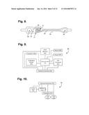 Ambulatory Electrocardiography Monitoring Patch Optimized For Capturing     Low Amplitude Cardiac Action Potential Propagation diagram and image