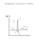 Ambulatory Electrocardiography Monitoring Patch Optimized For Capturing     Low Amplitude Cardiac Action Potential Propagation diagram and image