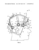 METHODS AND APPARATUS TO GATHER AND ANALYZE ELECTROENCEPHALOGRAPHIC DATA diagram and image