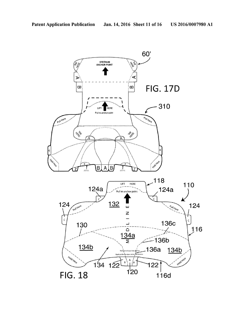 RETRACTOR/STABILIZER FOR EXCESSIVE AND/OR REDUNDANT TISSUE AND METHOD OF     USE - diagram, schematic, and image 12