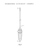 Method for Attaching a Prosthesis to Soft Tissue diagram and image