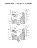 Method for Attaching a Prosthesis to Soft Tissue diagram and image