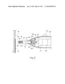 Method for Attaching a Prosthesis to Soft Tissue diagram and image